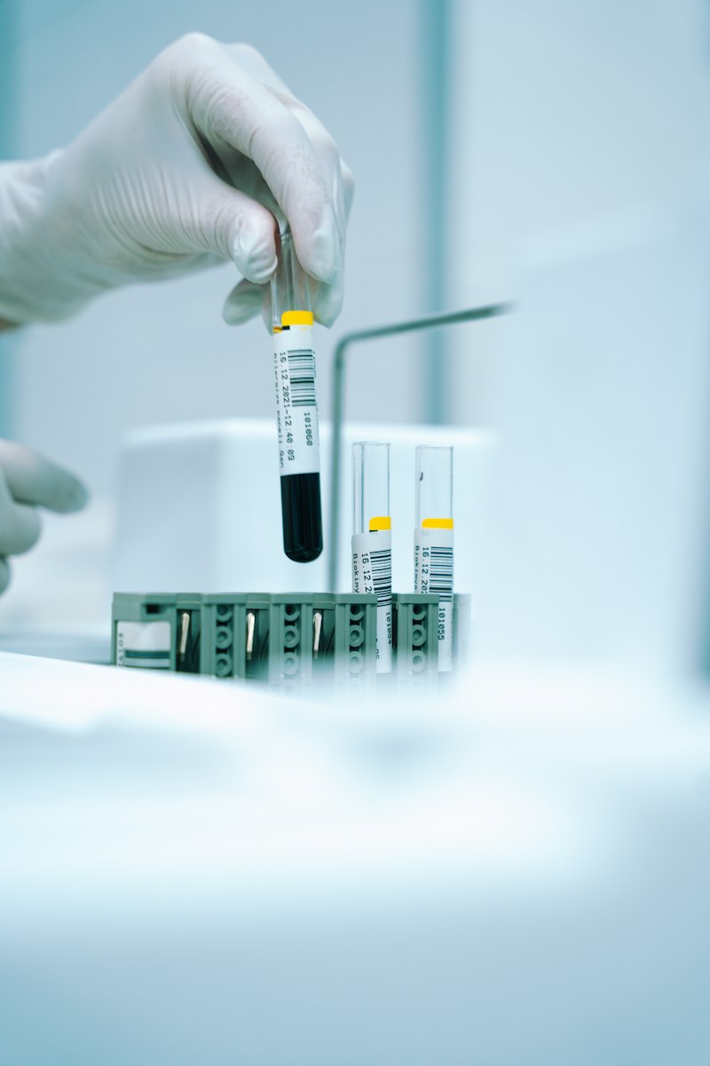 Detección temprana de cáncer de próstata en CDMX